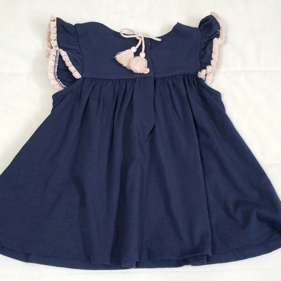 Tommy Bahama Girls Blue Two Piece Set - Picture 7 of 9